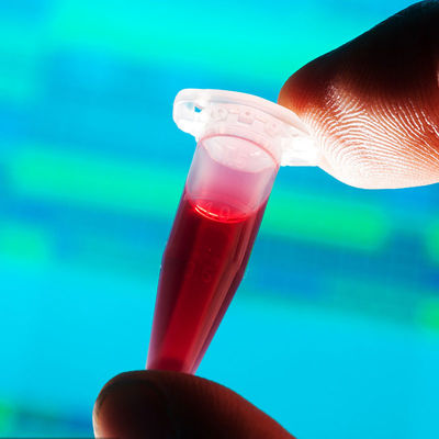 FDAはテスト ラボの急流の検出の食糧接触の哺乳瓶の第三者の認証サービスを承認した